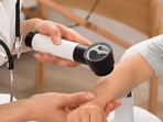 Melanoma is the deadliest form of skin cancer.(Shutterstock) Melanoma is the deadliest form of skin cancer.(Shutterstock)