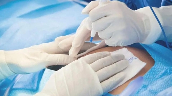There are many misconceptions and myths surrounding C-sections that can create anxiety and fear for expectant mothers. There are many misconceptions and myths surrounding C-sections that can create anxiety and fear for expectant mothers.