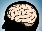 How monitoring blood vessel changes improves detection of brain diseases: Study(Shutterstock) How monitoring blood vessel changes improves detection of brain diseases: Study(Shutterstock)