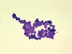 Prototheca appears to have developed a mechanism to elude detection by the immune system. (CDC) Prototheca appears to have developed a mechanism to elude detection by the immune system. (CDC)