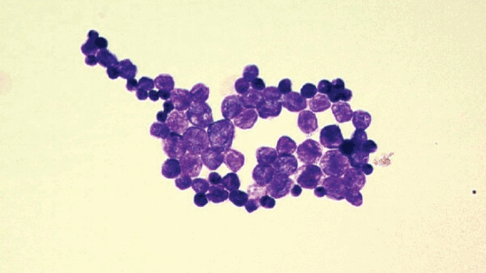 Prototheca appears to have developed a mechanism to elude detection by the immune system. (CDC) Prototheca appears to have developed a mechanism to elude detection by the immune system. (CDC)