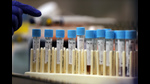 Data of close to 200 patients being treated for infections caused by carbapenem-resistant organisms across six hospitals in the country will be analysed during the course of the study. Carbapenem is a class of antibiotics usually reserved for known or suspected multidrug-resistant bacterial infections. (File photo for representation) Data of close to 200 patients being treated for infections caused by carbapenem-resistant organisms across six hospitals in the country will be analysed during the course of the study. Carbapenem is a class of antibiotics usually reserved for known or suspected multidrug-resistant bacterial infections. (File photo for representation)