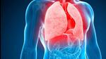 Limited data to support state’s TB preventive treatment of close contacts: Dr Zarir Udwadia Limited data to support state’s TB preventive treatment of close contacts: Dr Zarir Udwadia