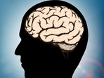 Association between traumatic brain injury and cardiovascular disease: Study(Shutterstock) Association between traumatic brain injury and cardiovascular disease: Study(Shutterstock)