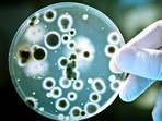 Gut fungus has long-term impact on the immunological response to severe COVID-19: Study(AFP/Istock) Gut fungus has long-term impact on the immunological response to severe COVID-19: Study(AFP/Istock)