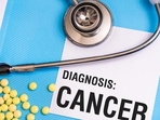 Cancer (representative image)(Shutterstock) Cancer (representative image)(Shutterstock)
