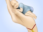 Pediatric cancers: Types, signs and symptoms, diagnosis, treatment (Photo by Shutterstock) Pediatric cancers: Types, signs and symptoms, diagnosis, treatment (Photo by Shutterstock)