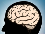 As Alzheimer's continues to silently afflict the brain long before noticeable symptoms emerge, a groundbreaking study in China unveils crucial insights.(Shutterstock) As Alzheimer's continues to silently afflict the brain long before noticeable symptoms emerge, a groundbreaking study in China unveils crucial insights.(Shutterstock)