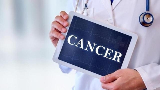 Treatment and prognosis: The prognosis for stomach cancer depends on various factors, including the stage at diagnosis, the extent of spread, and the overall health of the individual. Generally, stomach cancer diagnosed at an early stage has a better prognosis than cancer that has spread extensively. Surgery, chemotherapy, targeted therapy or a radiation therapy could be treatment given based on the stages of cancer. (Shutterstock)