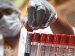 Maharashtra University of Health Sciences (MUHS) on Friday inaugurated its first genetic laboratory and cancer research centre in the city – MUHS Genehealth (REPRESENTATIVE IMAGE) Maharashtra University of Health Sciences (MUHS) on Friday inaugurated its first genetic laboratory and cancer research centre in the city – MUHS Genehealth (REPRESENTATIVE IMAGE)