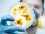 Stress triggers a series of molecules to work together to direct ER exit sites to lysosomes where they are destroyed.(Shutterstock) Stress triggers a series of molecules to work together to direct ER exit sites to lysosomes where they are destroyed.(Shutterstock)