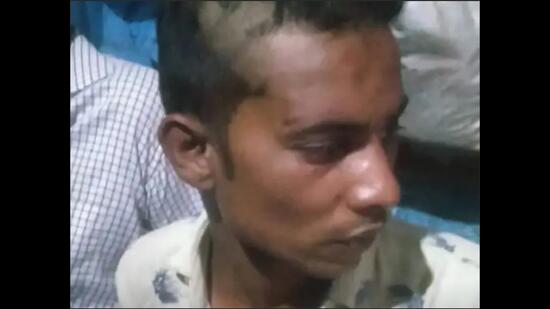 Mohammad Faiz, who was forcibly taken to the 35th PAC Btn HQs beaten and partially tonsured by cops in Lucknow. (Sourced) Mohammad Faiz, who was forcibly taken to the 35th PAC Btn HQs beaten and partially tonsured by cops in Lucknow. (Sourced)