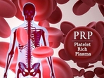 Platelet Rich Plasma Therapy: What it is? How is it used for vaginal rejuvenation (Photo by Orthopedic Implants India) Platelet Rich Plasma Therapy: What it is? How is it used for vaginal rejuvenation (Photo by Orthopedic Implants India)