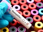 Lesser known facts about Haemophilia: Experts' insights on origin of disease and its impact on males (HT File Photo) Lesser known facts about Haemophilia: Experts' insights on origin of disease and its impact on males (HT File Photo)