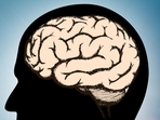 Donors with higher blood SMAD3 levels had less vascular damage and better Alzheimer's disease-related outcomes, according to the researchers.(Shutterstock) Donors with higher blood SMAD3 levels had less vascular damage and better Alzheimer's disease-related outcomes, according to the researchers.(Shutterstock)