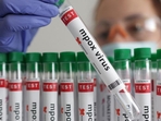 Mpox is a zoonotic disease caused by the monkeypox virus. This virus is a DNA virus, unlike the SARS-CoV-2 virus which is an RNA virus. (REPRESENTATIVE PHOTO) Mpox is a zoonotic disease caused by the monkeypox virus. This virus is a DNA virus, unlike the SARS-CoV-2 virus which is an RNA virus. (REPRESENTATIVE PHOTO)