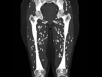 Dr Sam Ghali shared the CT scan image of a patient with cysticercosis. (X/@EM_RESUS) Dr Sam Ghali shared the CT scan image of a patient with cysticercosis. (X/@EM_RESUS)