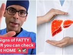Dr. Saurabh Sethi highlights five signs of fatty liver that can be checked at home. (Instagram/@doctor.sethi) Dr. Saurabh Sethi highlights five signs of fatty liver that can be checked at home. (Instagram/@doctor.sethi)