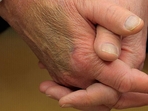 When Trump and Macron sat in front of reporters and gave each other a long, awkward handshake, the bruise - which was disguised with makeup - was noticed. X users offered their own hypotheses on the potential source of the bruise after a close-up of Trump's hand showed discoloration.(AP/X) When Trump and Macron sat in front of reporters and gave each other a long, awkward handshake, the bruise - which was disguised with makeup - was noticed. X users offered their own hypotheses on the potential source of the bruise after a close-up of Trump's hand showed discoloration.(AP/X)