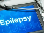 Epilepsy(Shutterstock) Epilepsy(Shutterstock)