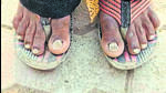 Mysterious malady in Buldhana: After hair loss, villagers lose nails Mysterious malady in Buldhana: After hair loss, villagers lose nails