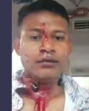 Wing Commander Shiladitya Bose shared a video on X in which he could be seen with blood on his face. (X) Wing Commander Shiladitya Bose shared a video on X in which he could be seen with blood on his face. (X)
