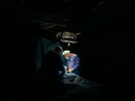A man in southern China survived after a metal rod pierced his head during a fall. (Representational image/Pexels) A man in southern China survived after a metal rod pierced his head during a fall. (Representational image/Pexels)