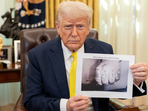 Trump appeared to show a digitally altered photo of Kilmar Abrego Garcia's tattoos(Truth Social/Donald Trump) Trump appeared to show a digitally altered photo of Kilmar Abrego Garcia's tattoos(Truth Social/Donald Trump)