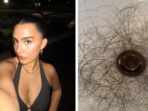 Kyle Richards' daughter, Sophia Umansky, opens up on shocking hair loss after taking a weight loss drug(TikTok/ Sophia Umansky) Kyle Richards' daughter, Sophia Umansky, opens up on shocking hair loss after taking a weight loss drug(TikTok/ Sophia Umansky)